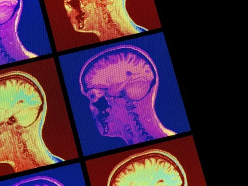Brain wearable technology and wellness
